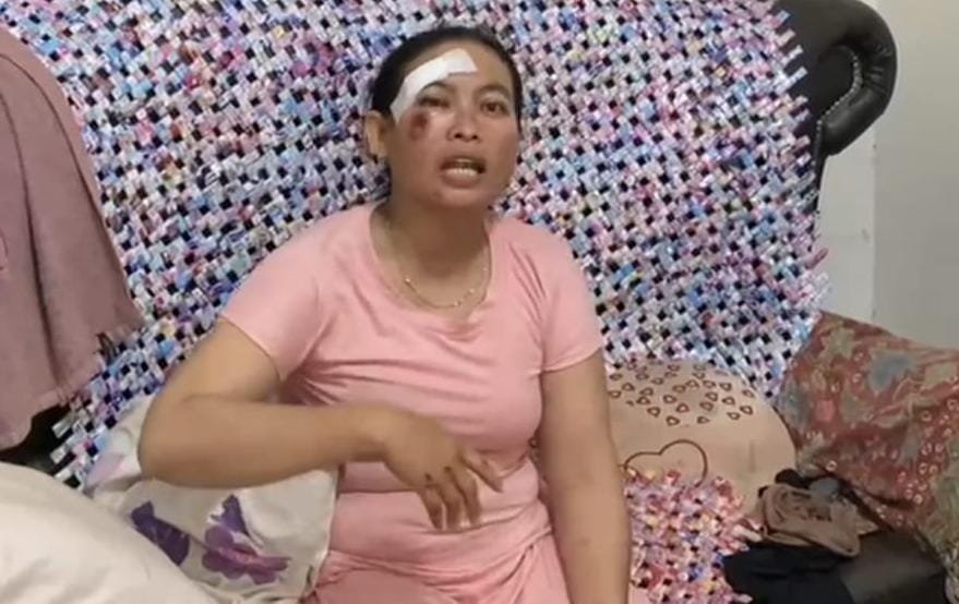 Ellima (41), penjual kulit lumpia yang menjadi korban begal bersenjata api, menunjukkan luka jahitan di kepala usai membuat laporan di Polda Sumsel, Rabu (10/12/2025).