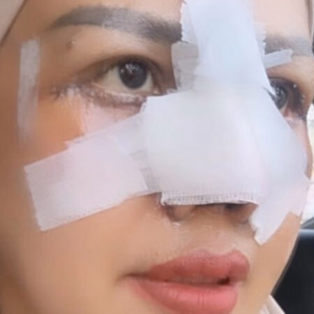 Elly Sugigi Bongkar Biaya Operasi Plastik Rp85 Juta, Akui Tak Keluar Uang Sepeser Pun